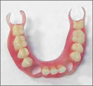 Removable nylon dentures in Chisinau