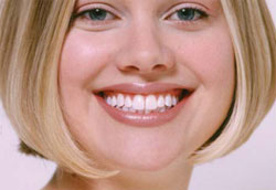 Teeth beforeafter bleaching