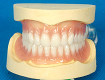 Complete dental prosthesis in Chisinau