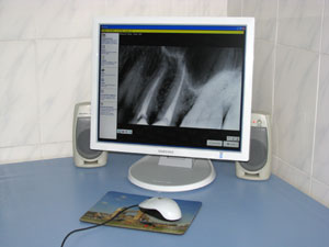 Visiograph in Dental clinic Chisinau Moldova